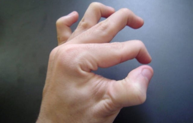 bodyfacts_034 bodyfacts_034