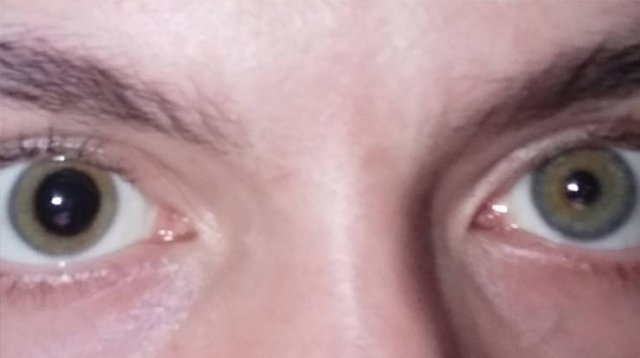 bodyfacts_043 bodyfacts_043